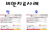 비만치료사례